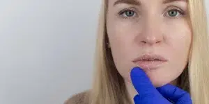 labios secos tratamientos