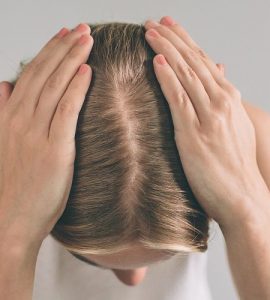perdida cabello mujer