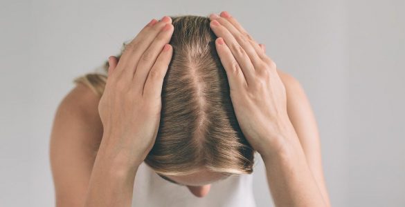 perdida cabello mujer