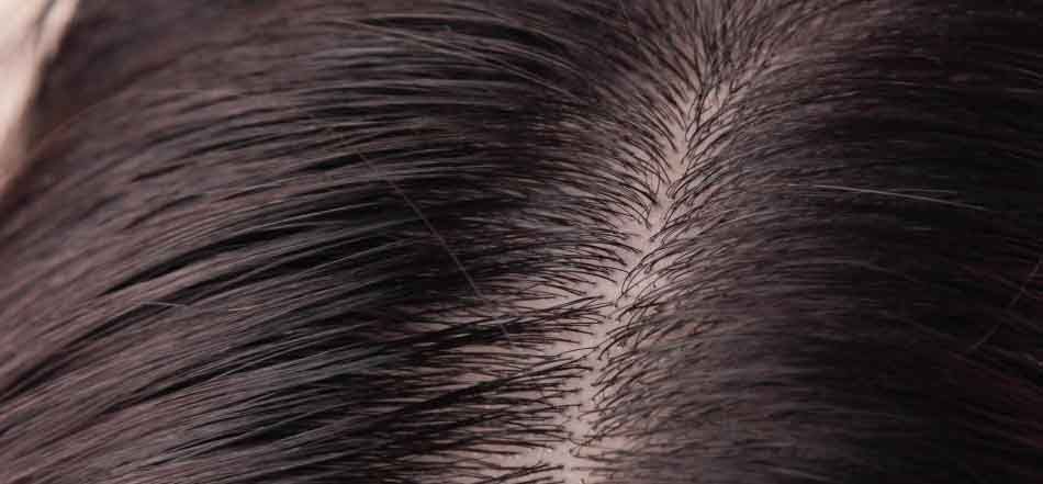 Dolor de cuero cabelludo: causas y IML