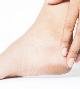 persona tocándose talón