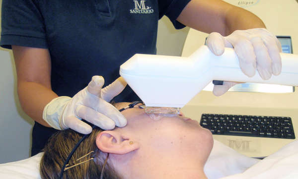 Tratamiento de rejuvenecimiento facial con IPL (Luz Pulsada Intensa)