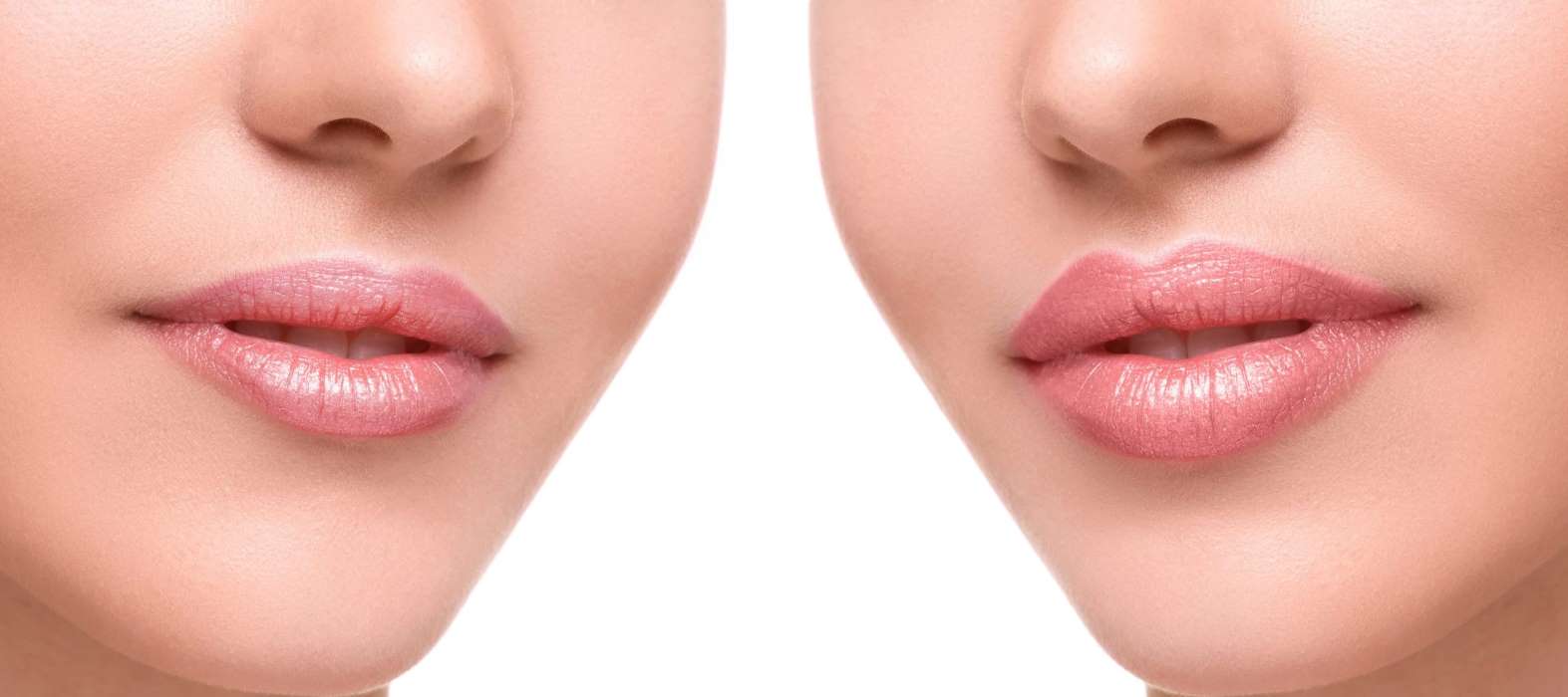 Сделать форму губ. Формы губ. Разные формы губ. Коррекция формы губ косметика. Изменение и улучшение формы губ,.