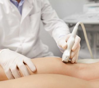 doctor quitando varices