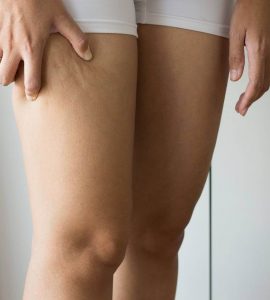 piernas de mujer