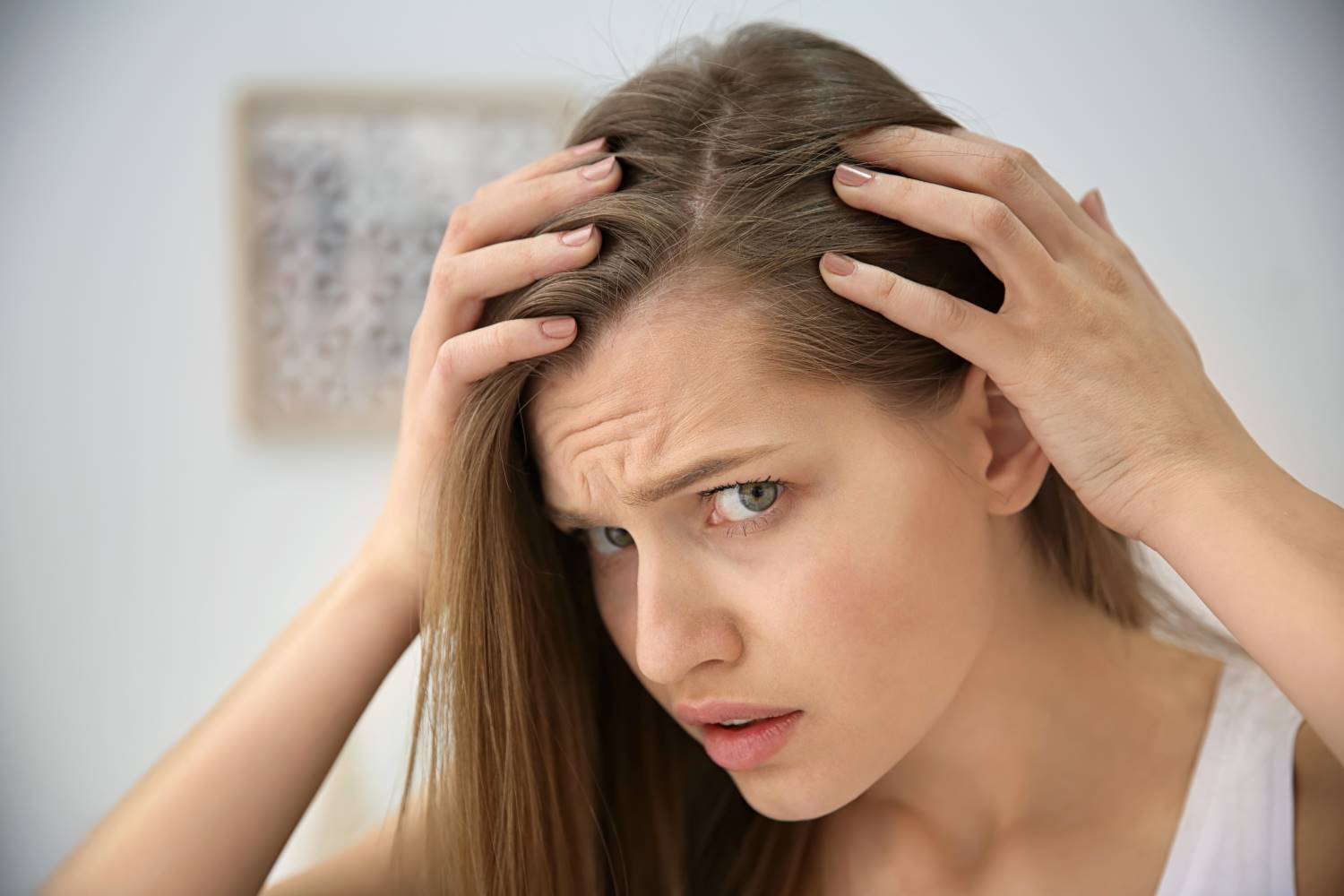 Flecha Eclipse solar Violar ▷ La alopecia frontal fibrosante, causas y tratamientos | IML