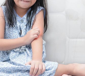 niña tocandose brazo