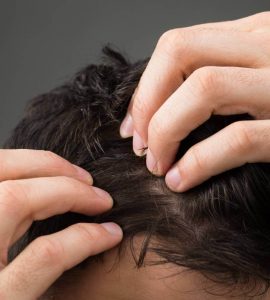 hombre tocando su pelo