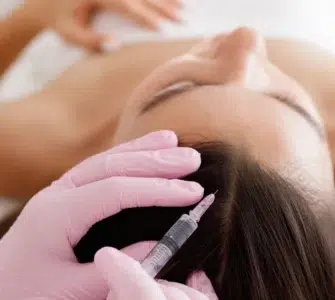 Tratamiento del liquen plano pilar en Madrid