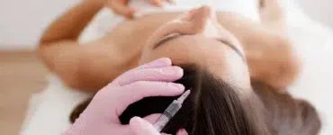 Tratamiento del liquen plano pilar en Madrid