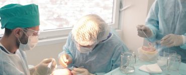 Ventajas del injerto capilar en IML
