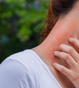 mujer rascando cuello