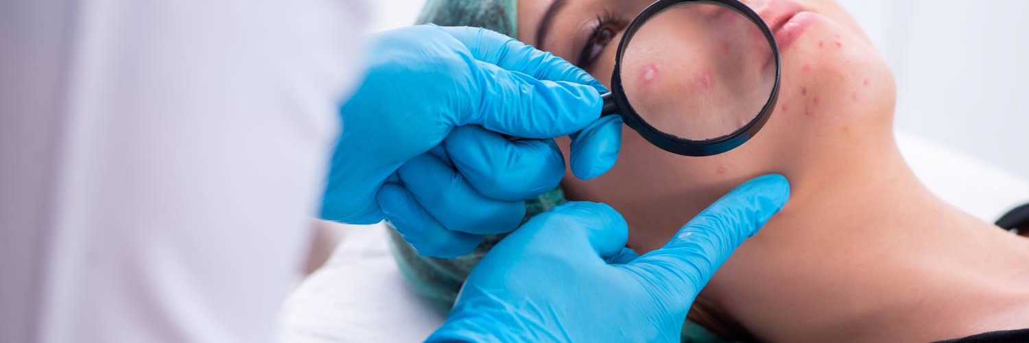 dermatologo revisasndo acne