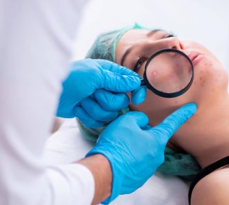 dermatologo revisasndo acne