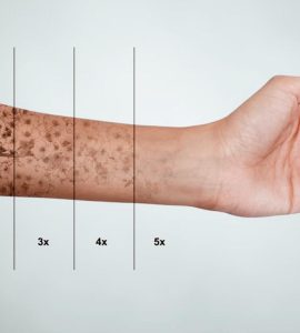 borrar tatuaje de forma natural