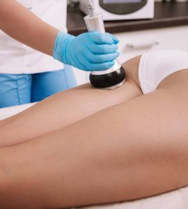 tratamientos radiofrecuencia fraccionada