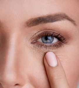 arrugas debajo de los ojos