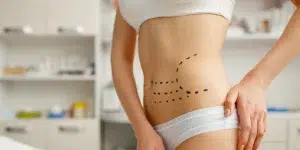 cirugias de abdomen