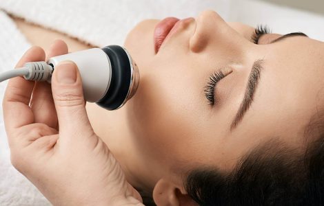 radiofrecuencia facial
