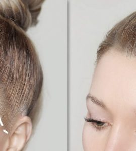 Biofibras capilares: una alternativa al injerto capilar