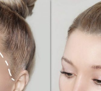 Biofibras capilares: una alternativa al injerto capilar