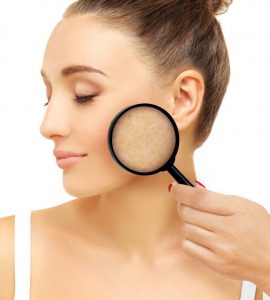 como actuar contra melasma