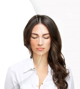 como prevenir melasma
