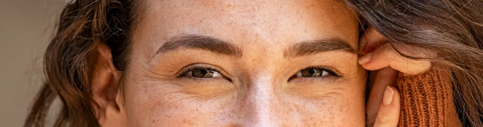 Patas de gallo en jóvenes: por qué aparecen y cómo eliminarlas