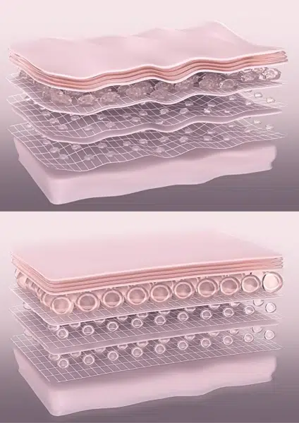 Antes y después de la hidratación profunda de los tejidos de la piel