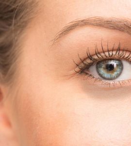 quitar ojeras hereditarias