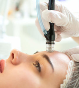IML SkinCenter: el primer paso para tu belleza facial
