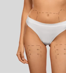 Cirugia estetica 2025