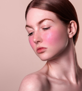 cuperosis y rosacea
