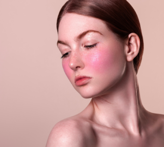 cuperosis y rosacea