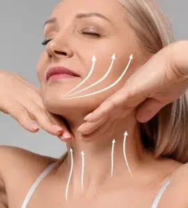 Descolgamiento facial iml clinic
