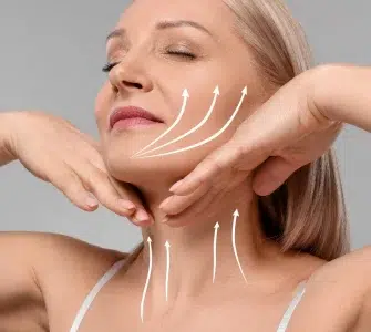 Descolgamiento facial iml clinic