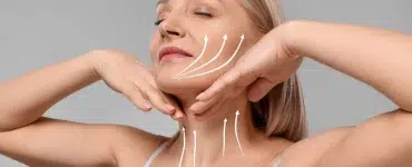 Descolgamiento facial iml clinic