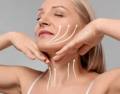 Descolgamiento facial iml clinic