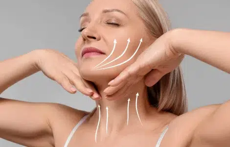 Descolgamiento facial iml clinic