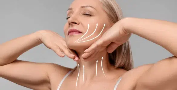 Descolgamiento facial iml clinic