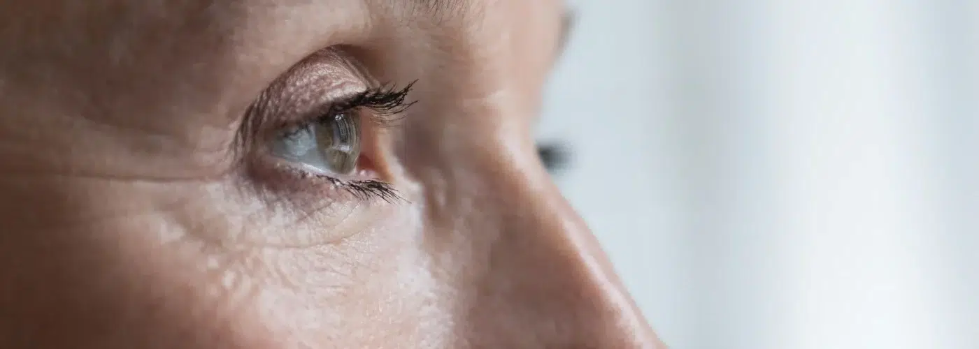 blefaroplastia laser co2