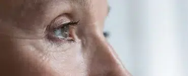 blefaroplastia laser co2
