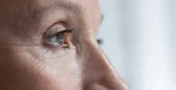 blefaroplastia laser co2