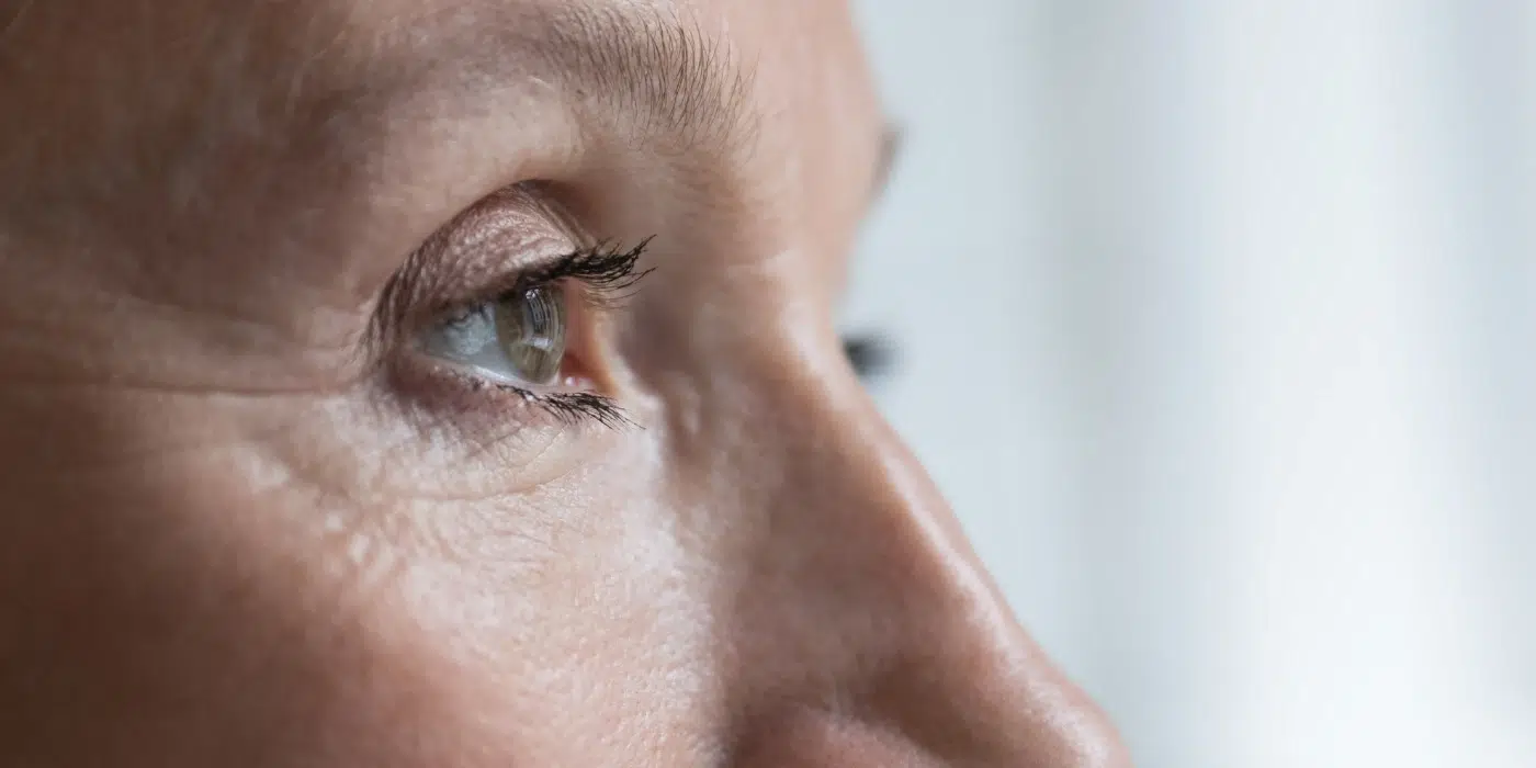 ¿Deja cicatriz la blefaroplastia láser? Todo lo que necesitas saber sobre el postoperatorio