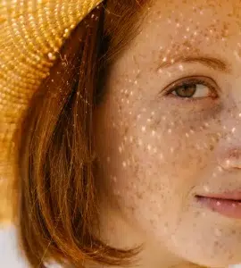 Proteccion solar en verano