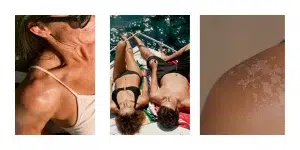 como cuidar la piel en verano