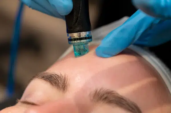 Hydrafacial reduce brillos en la piel