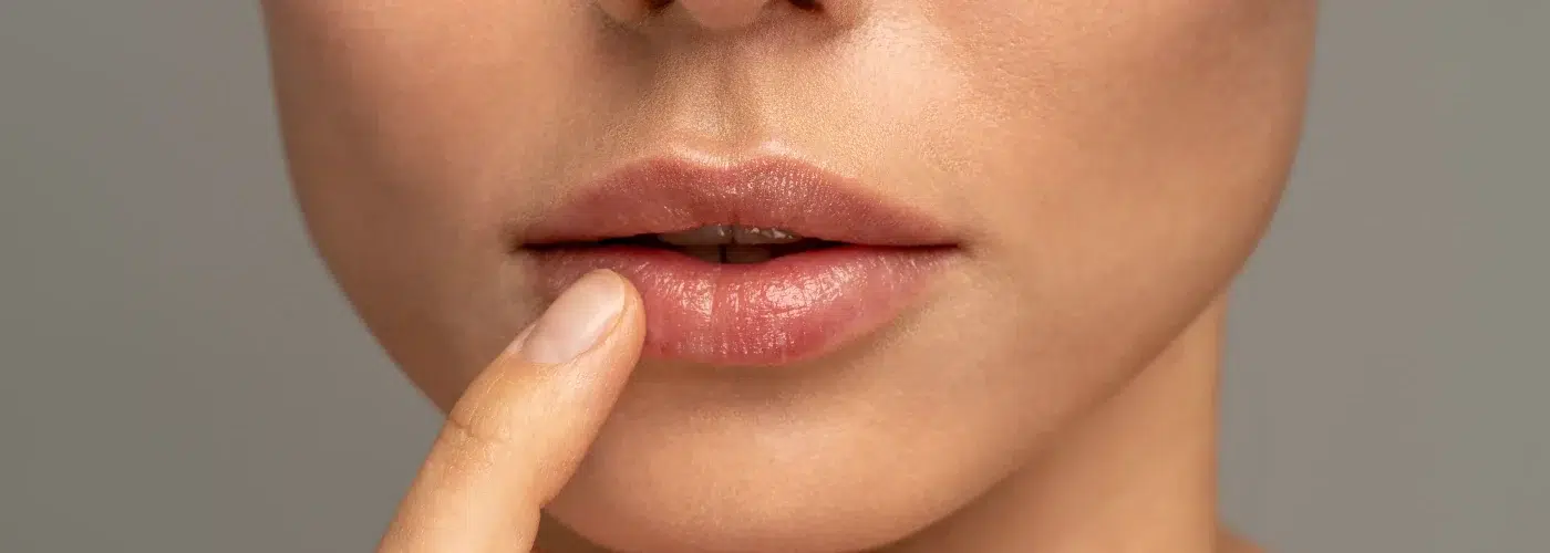 Ácido hialurónico para labios