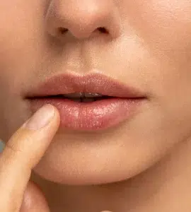 Ácido hialurónico para labios