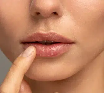 Ácido hialurónico para labios